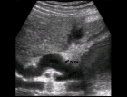 images/thumbs/Fall4Sonografie.png